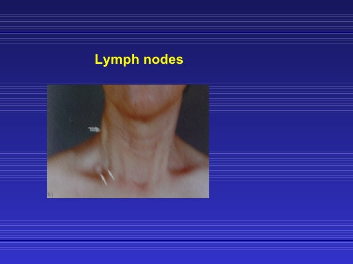 breast cancer lymph nodes neck Breast cancer lymph nodes neck